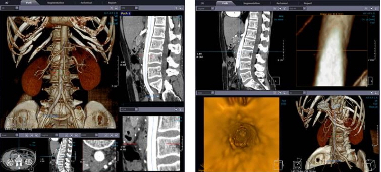 건양대 방사선학과, 학부생 교육 위해 디지털 3D 교육 프로그램 도입